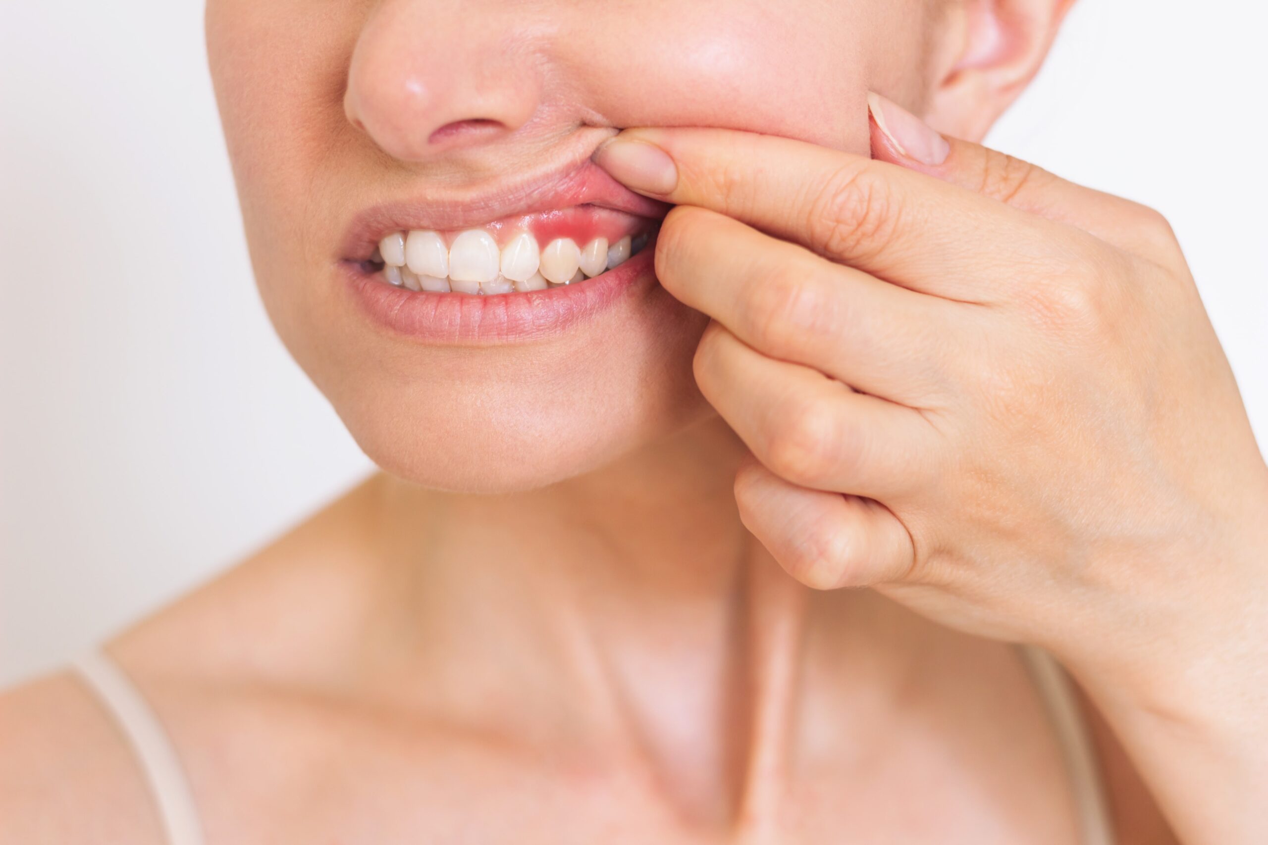 cómo afectan los cambios hormonales a la salud bucodental
